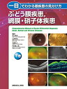 【中古】 一目でわかる眼疾患の見分け方 下巻 ぶどう膜疾患,網膜・硝子体疾患