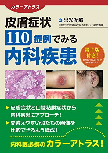【中古】 カラーアトラス 皮膚症状110症例でみる内科疾患【電子版付き】