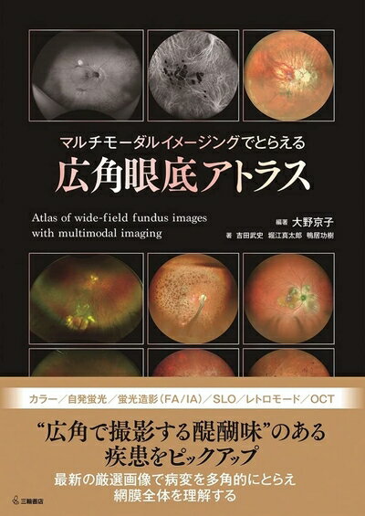 【中古】 マルチモーダルイメージングでとらえる 広角眼底アトラス