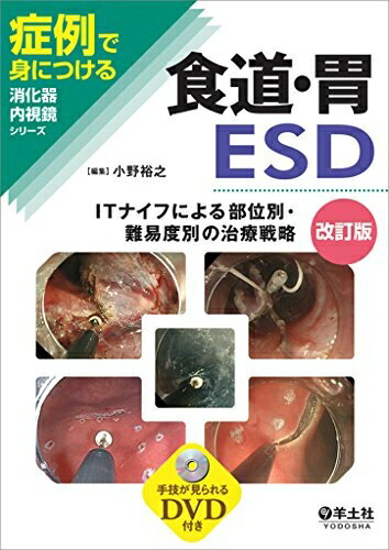 【中古】 食道・胃ESD改訂版〜ITナイフによる部位別・難易度別の治療戦略 (症例で身につける消化器内視..