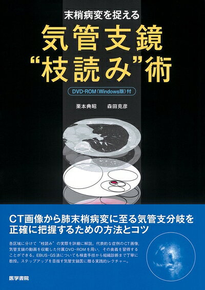 楽天市場】気管支鏡 枝読みの通販