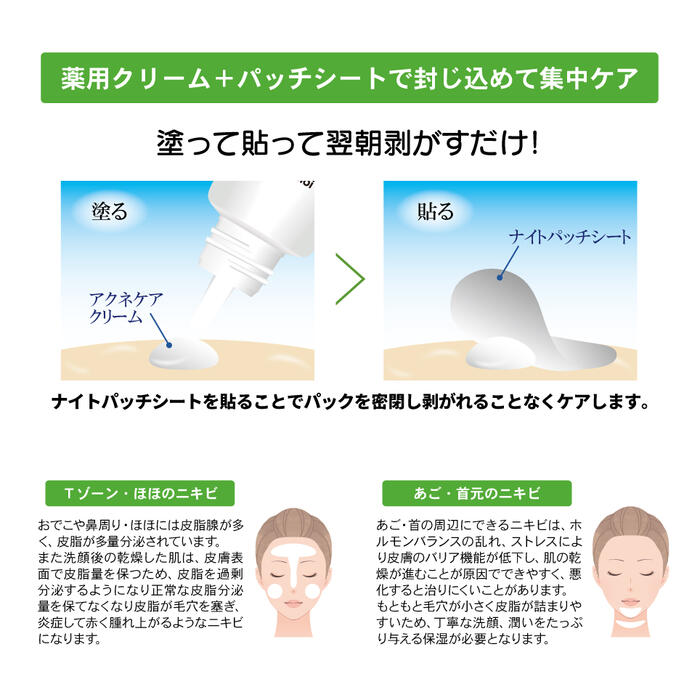 �ڥ᡼���ز�ǽ��9���ޤǡˡ�Acn-aid(�����ͥ���)���ʥ��ȥѥå������� �ڥ����⥢��Can-aid(�����ͥ���)���ʥ��ȥѥå������ȡ��˥����ѡ��˥��ӥ������˥����к�����ȩ�������󥱥����ե���������n��