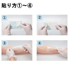 オプサイト　クイックロール　【5cm×3m】 スミス・アンド・ネフュー　ウンドマネジ...
