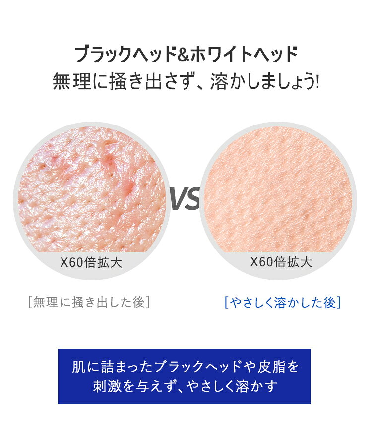 国内発送 翌日発送 One Days You ワンデイズユー ブラックヘッド 鼻パック ノーモアブラックヘッド 決算特価商品 100mlone You Lattencos 植物エキス ホワイトヘッド 角質 ラテアンドコス いちご鼻 毛穴 低刺激 皮脂 鼻