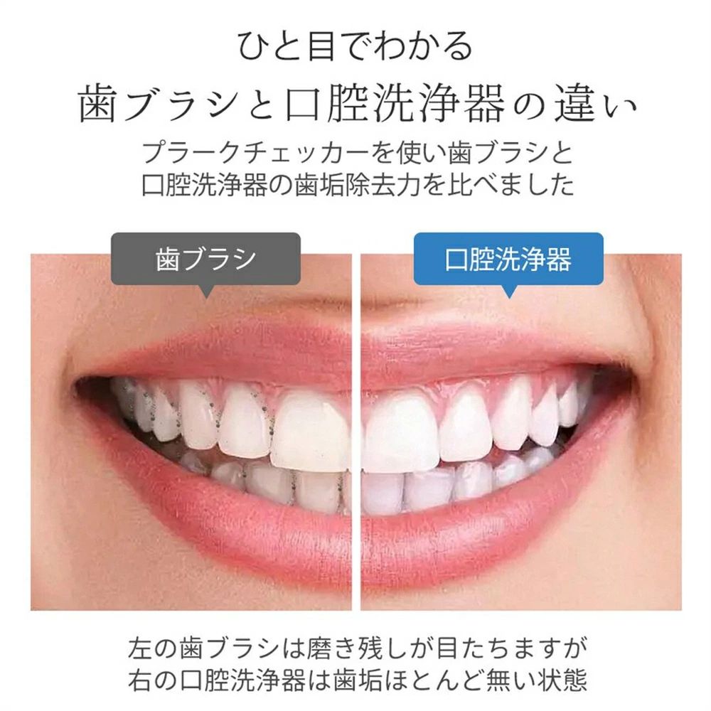 口腔洗浄器 ジェットウォッシャー 2025最新 歯科先生監修 コードレス口腔洗浄機 コ...