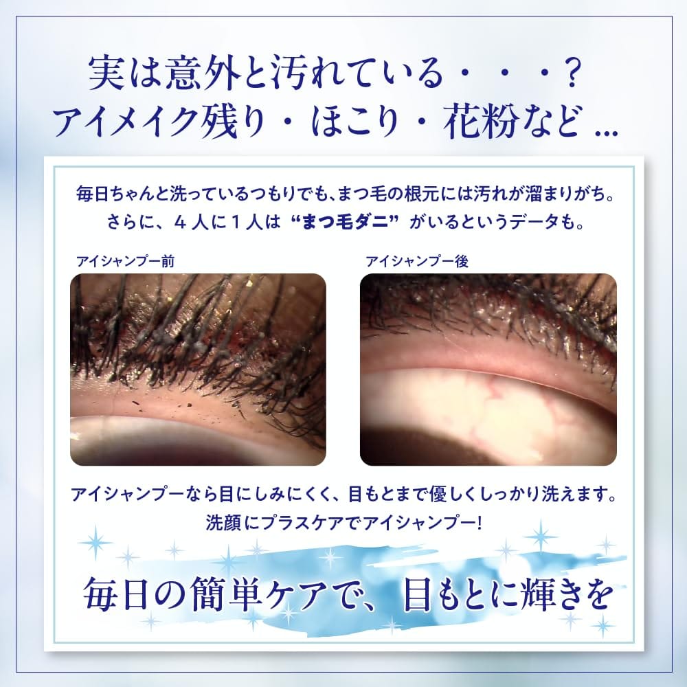 �ޤ��ӡ��ܤ�����ѥ����ס� ���������ס��ץ� 200ml ��ʥ���˥å��Ǥμ���¿�� �ܤ�������� ��åɥϥ������� �ޥ��ܡ��������� �ܤδ�������ʴ���ޤ��ӥ���