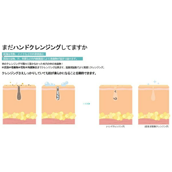 CELL RETURN�å���꥿���� BURUBABU egg�ʥ֥�Х֥��å��� �ѡ��ץ� FC-M1-001