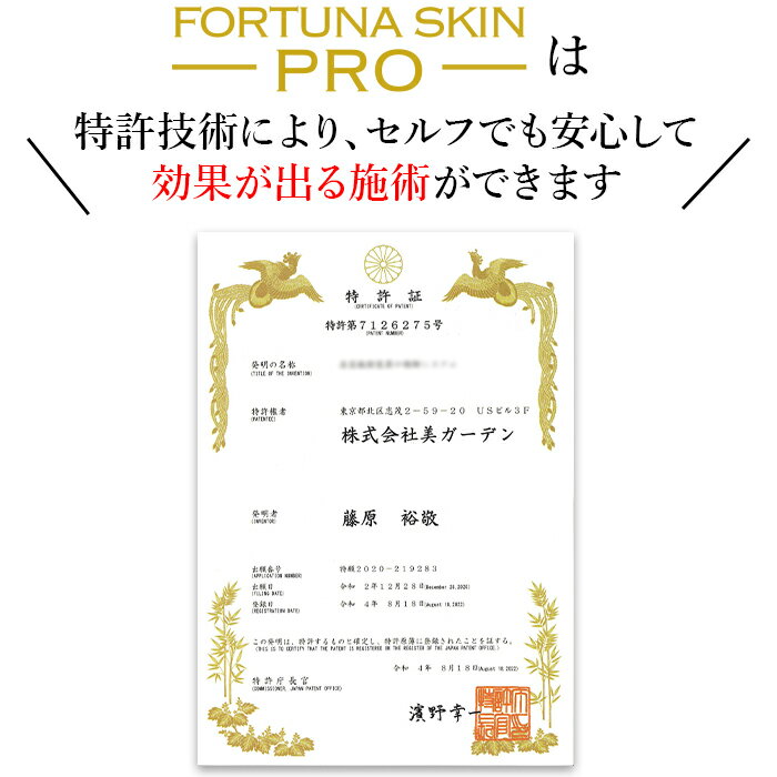 FORTUNA SKIN PRO 脱毛/光フェ...の紹介画像3