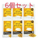 屋久島 春ウコン粒300粒 6袋セット 屋久島産 無農薬 有機栽培 サプリメント