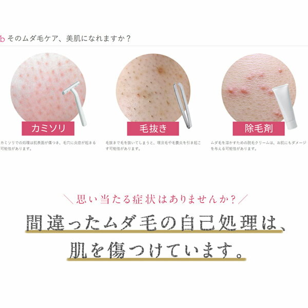 Prona フラッシュ脱毛器 専用取り換えカートリッジ クール用(身体用)