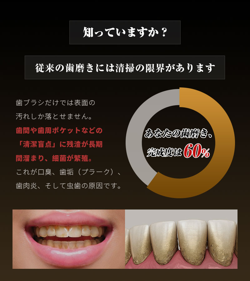 超音波スケーラー 家庭用 歯石除去器 プロ級 歯茎に優しい お家で本格ホワイトニン...