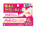 【第2類医薬品】アットノン EX クリーム 15g 【正規品】【t-10】