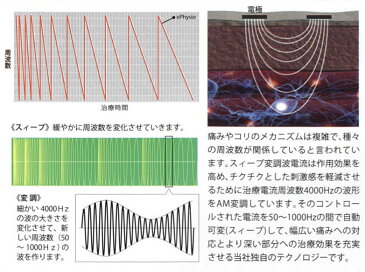 ひざ治療器 ひざケア ひざ専用 家庭用 （SM1MT）低周波治療器 膝 痛み 医療機器認証 日本製 マルタカテクノあす楽 送料無料