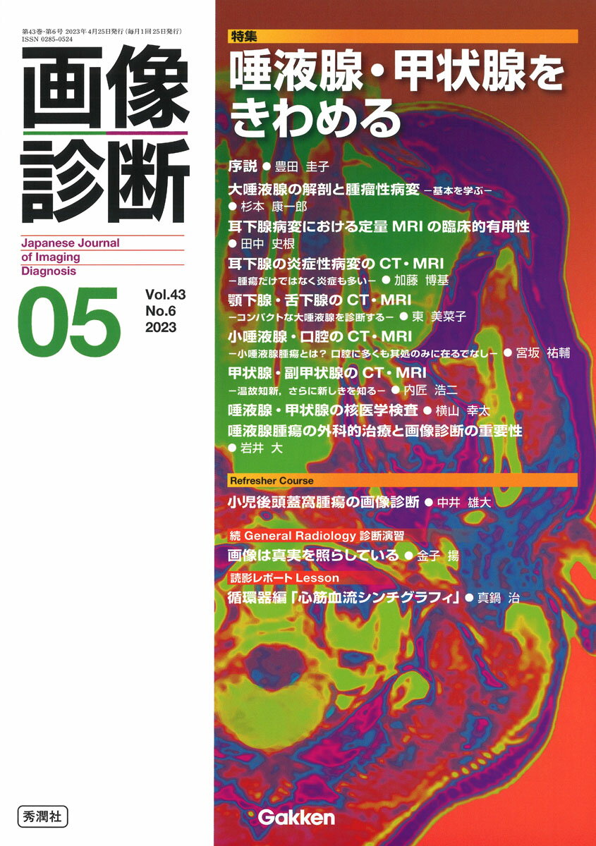 画像診断2023年5月号　Vol．43　No．6 唾液腺・甲状腺をきわめる [ 画像診断実行編集委員会 ]