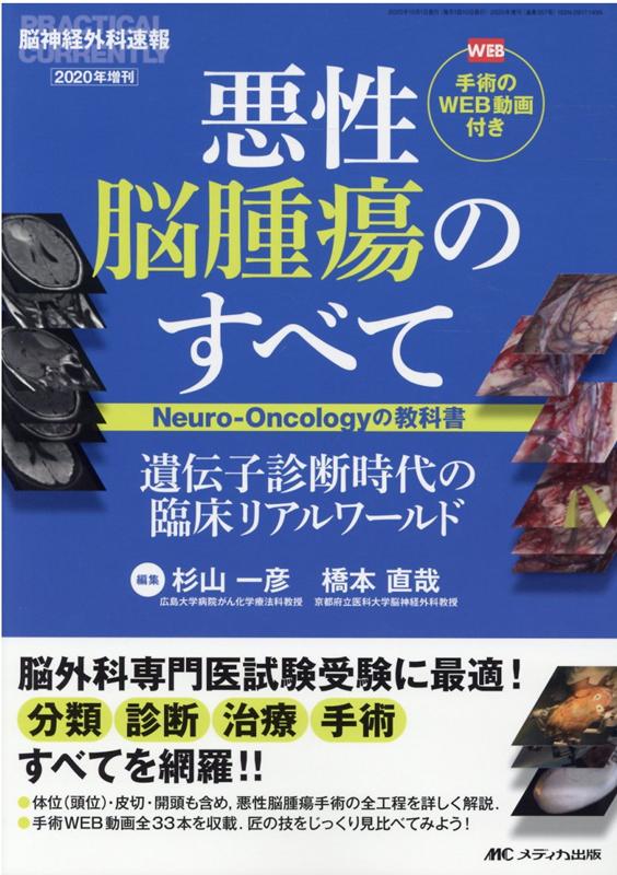 悪性脳腫瘍のすべて -Neuro-Oncologyの教科書ー