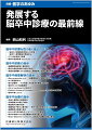 脳卒中の予防や治療に必須の最新知見を各分野のをエキスパートが解説！

●脳卒中は日本人の国民病であるにもかかわらず、その治療法の少なさも相まって長年にわたり過小評価されてきた歴史がある。
●脳卒中に対する予防、国民への啓発、医療体制の充実、登録事業や脳卒中研究の強化、脳卒中に関わる人材の育成など課題は山積している。
●本特集では、脳卒中診療を取り巻く最近の話題、脳卒中診断の進歩、脳卒中病態解明の進歩、脳卒中治療の進歩に関して、わが国を代表する専門家の執筆陣が詳しく解説！


【目次】
脳卒中診療を取り巻く最近の話題
　1．「脳卒中と循環器病克服5ヵ年計画」と「脳卒中・循環器病対策基本法
　2．コロナ禍と脳卒中診療
　3．脳卒中遠隔医療（telestroke）システム
脳卒中診断の進歩
　4．脳梗塞画像診断の最新動向
　5．脳卒中超音波診断の最近の動向
　6．潜因性脳梗塞における潜在性心房細動検出技術の最新情報
脳卒中病態解明の進歩
　7．Neurovascular unit─脳梗塞発症から機能回復まで
　8．がん関連脳卒中
　9．脳小血管病─その負債に予防医学的閾値はあるか？
　10．脳卒中における脳腸連関
　11．Atrial cardiopathyと脳卒中
　12．Embolic Stroke of Undetermined Source（ESUS）の最新動向
　13．脳卒中後てんかん
脳卒中治療の進歩
　14．抗血小板療法の最新動向
　15．抗凝固療法の最近の動向
　16．脳血管内治療の進歩
　17．脳塞栓症予防の心臓手術─卵円孔開存閉鎖術、左心耳閉鎖術
　18．脳梗塞再生医療の進歩
　19．HALが切り拓く脳卒中リハビリテーションの進歩
　20．脳卒中診療における経頭蓋磁気刺激治療の進歩
　21．Brain-Machine Interfaceによる脳卒中後機能回復の展望