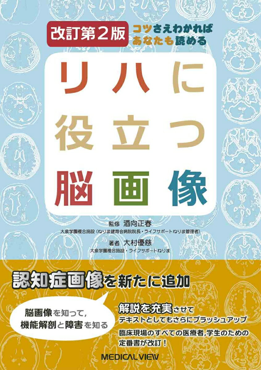 コツさえわかればあなたも読める リハに役立つ脳画像