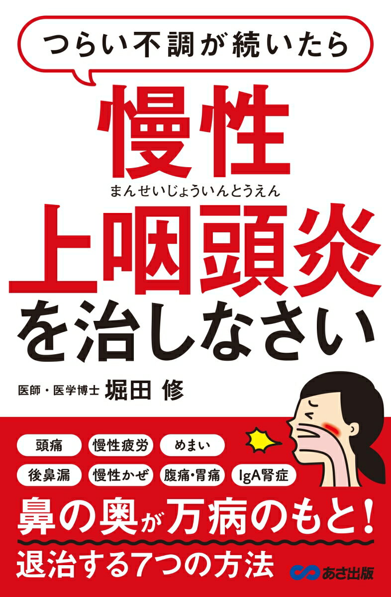 つらい不調が続いたら慢性上咽頭炎を治しなさい