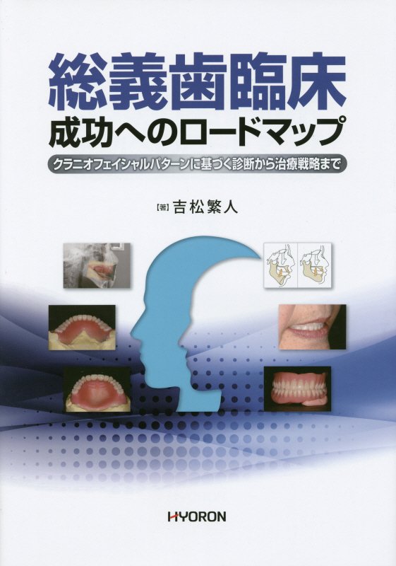 総義歯臨床　成功へのロードマップ