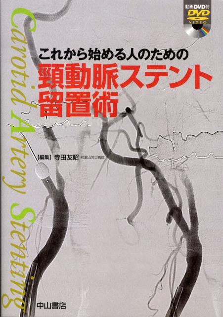 これから始める人のための頚動脈ステント留置術
