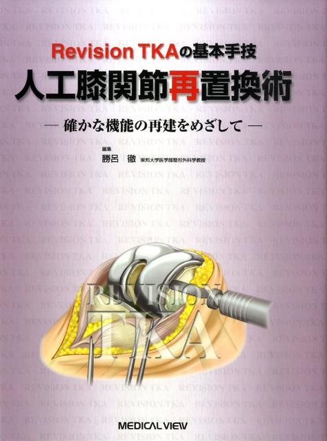 人工膝関節再置換術