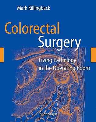 Colorectal Surgery: Living Pathology in the Operating Room is two books in one. First, it is an atlas in the classic definition: each chapter is a two-page spread discussing one case. Functionally, each chapter is a case study with both the surgical and pathological perspectives beautifully rendered and fully explained.Visually, every chapter presents the reader with operative and/or diagnostic photos, and anatomic line drawings by the author. The text, more extensive than in many atlases, provides a concise yet complete operative record: patient history/work up, anatomic anomalies, the procedure itself, pathologic findings, and follow up.Key teaching points emphasize the most important and unique aspects of every case. Residents, fellows, and even seasoned practitioners will gain valuable diagnostic and therapeutic insights from this material. The case study presentation provides an excellent review tool for the American Board of Colon and Rectal Surgery exam.