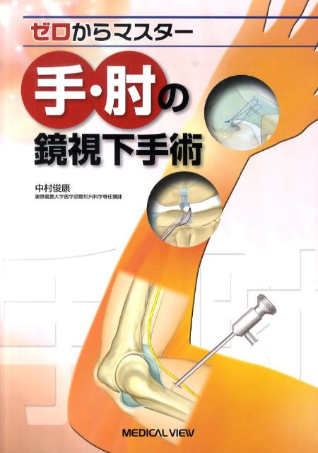 ゼロからマスター手・肘の鏡視下手術