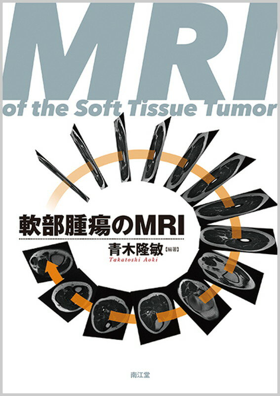 軟部腫瘍のMRI 