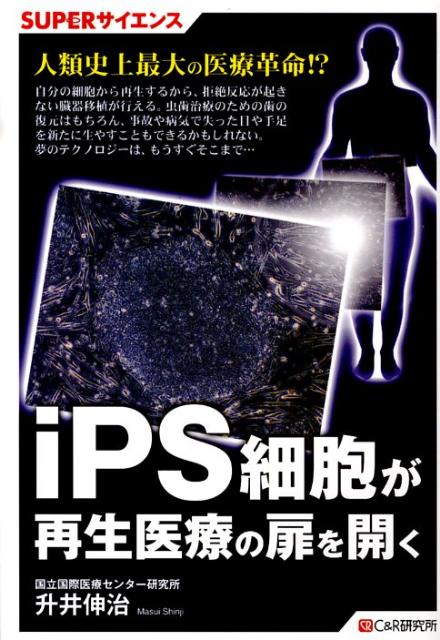 iPS細胞が再生医療の扉を開く （SUPERサイエンス） [ 升井伸治 ]