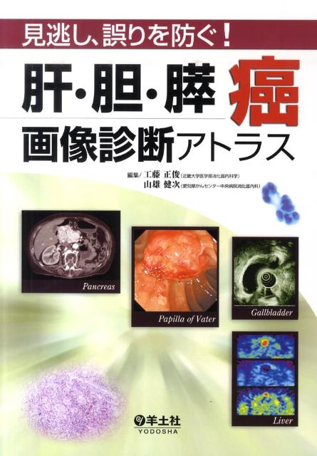 肝・胆・膵癌画像診断アトラス