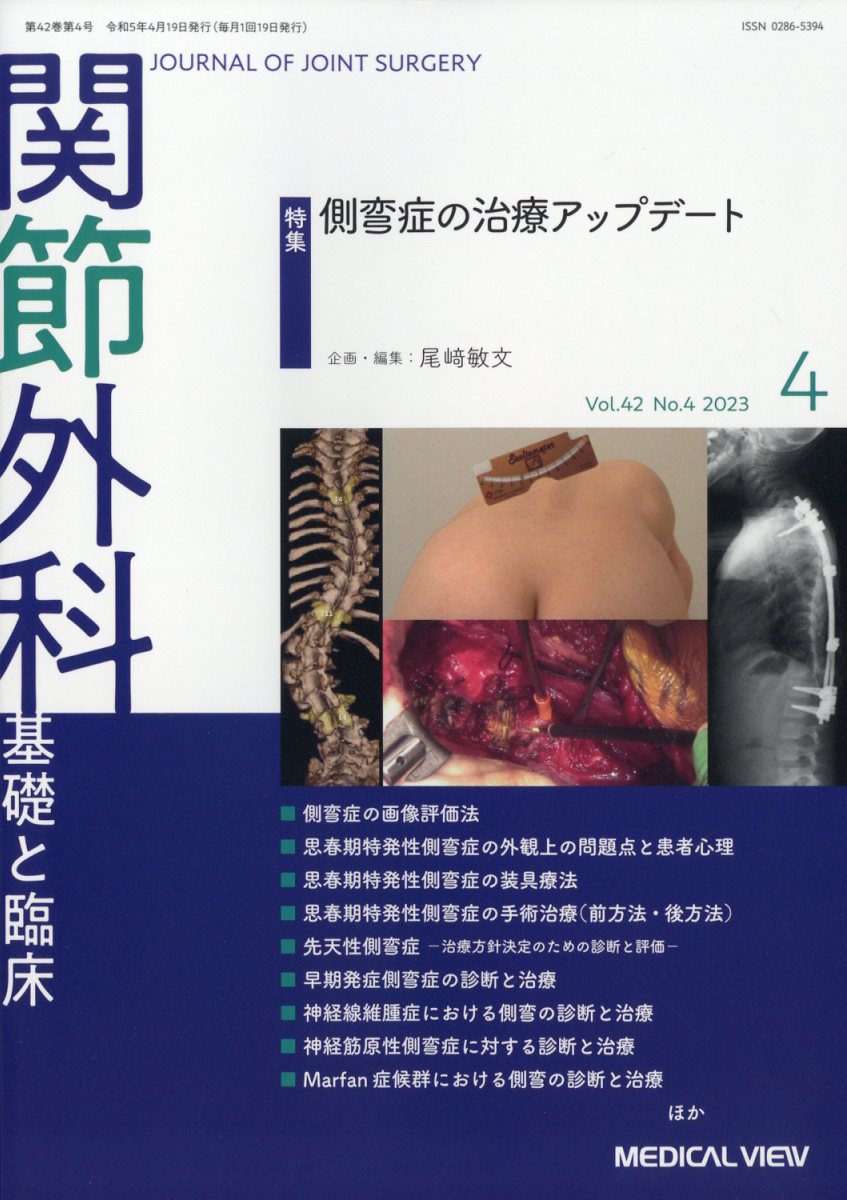 関節外科 基礎と臨床 2023年 4月号 [雑誌]