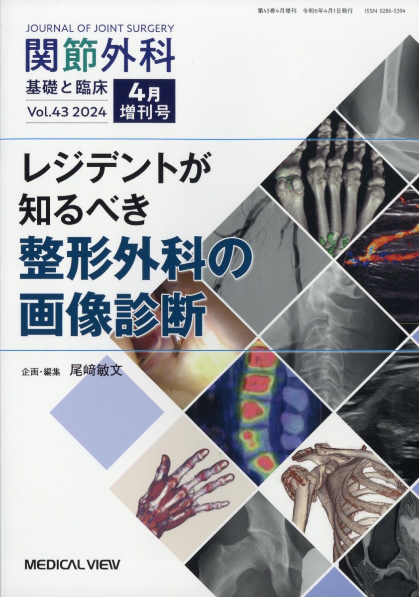 レジデントが知るべき整形外科の画像診断 2024年 4月号 [雑誌]