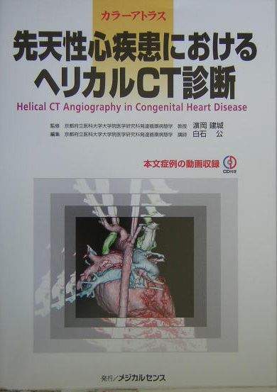 先天性心疾患におけるヘリカルCT診断