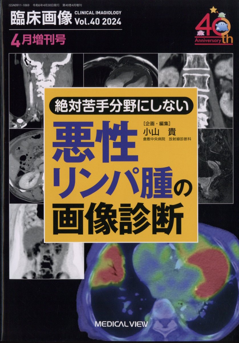 増刊臨床画像 絶対苦手にしない 全身の悪性リンパ腫 2024年 4月号 [雑誌]