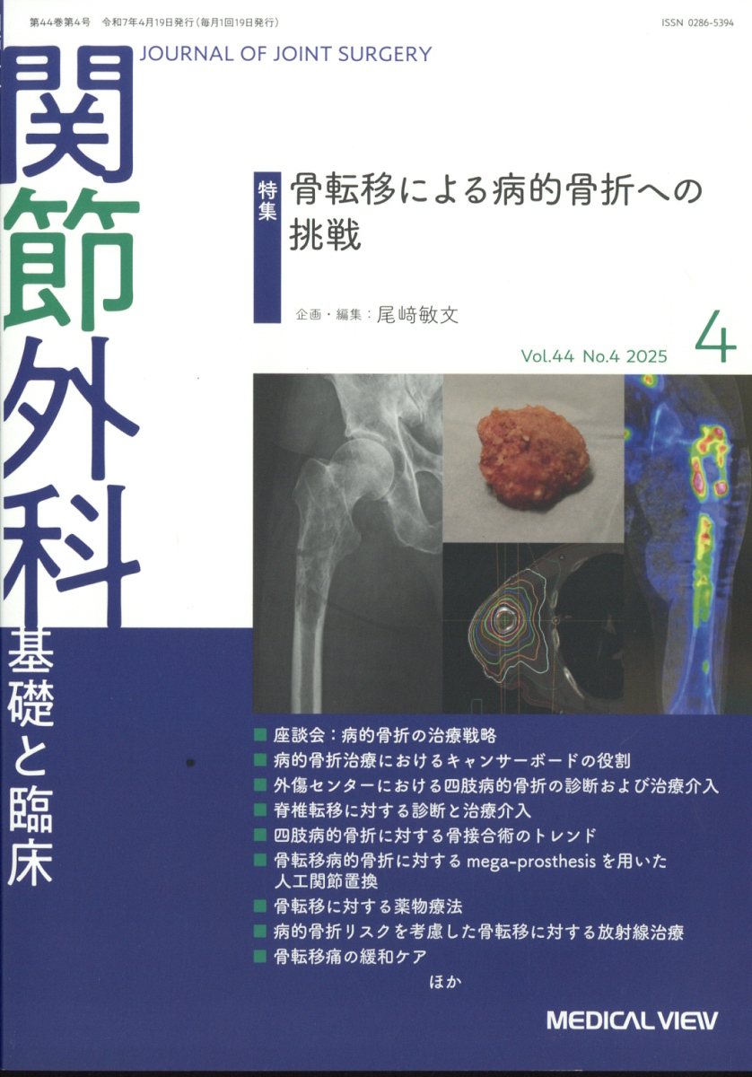 関節外科 基礎と臨床 2025年 4月号 [雑誌]