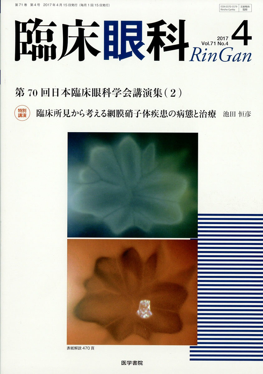 臨床眼科 2017年 04月号 [雑誌]