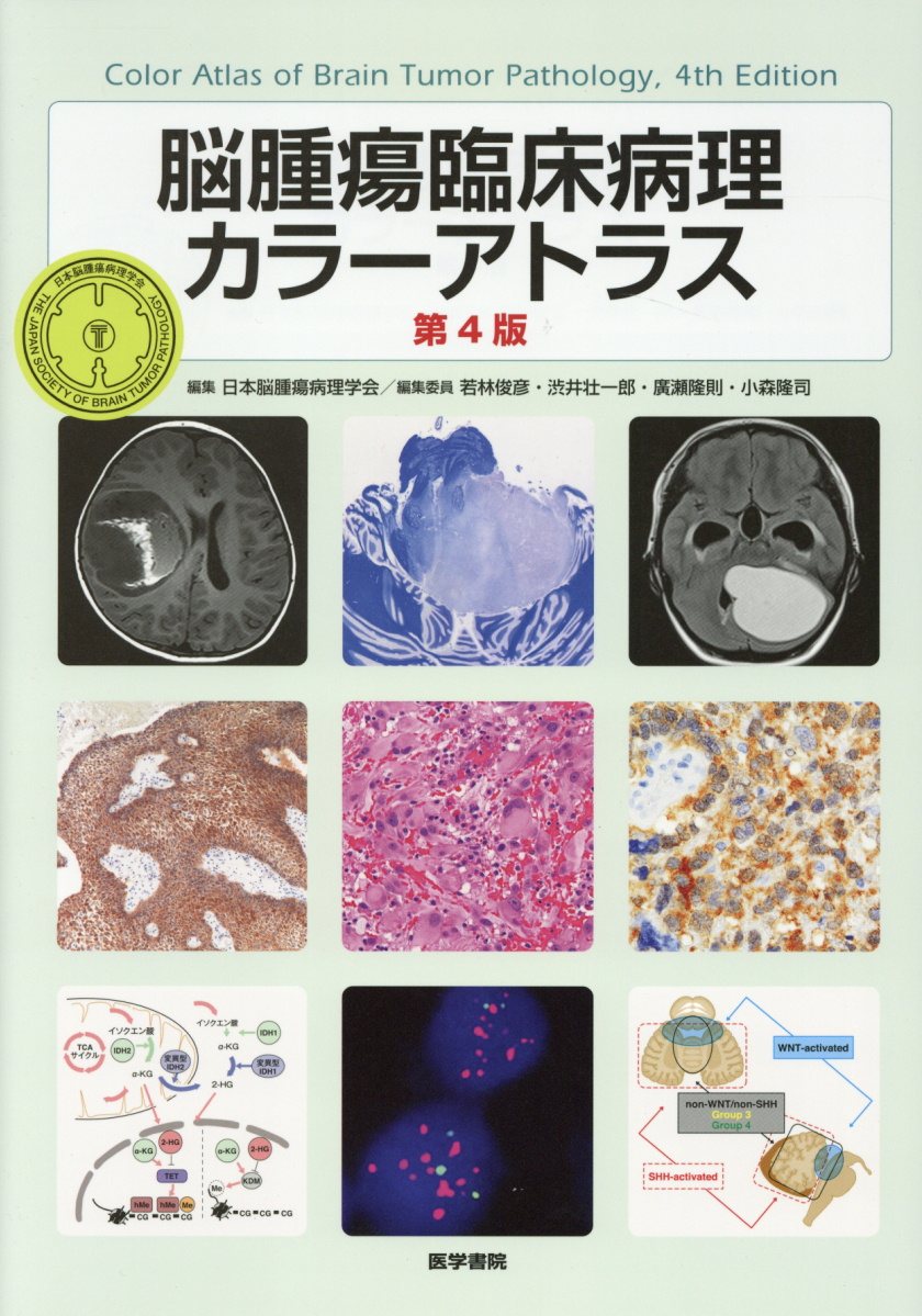 脳腫瘍臨床病理カラーアトラス 第4版