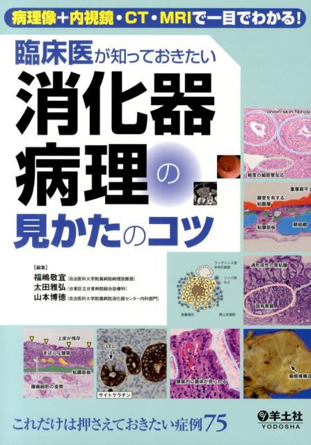 臨床医の素朴なギモンをふまえ、病理像の見かたのコツを病理医が伝授。症例をイメージしやすいよう、内視鏡像、ＣＴ・ＭＲＩ、血液検査値など臨床情報も掲載。