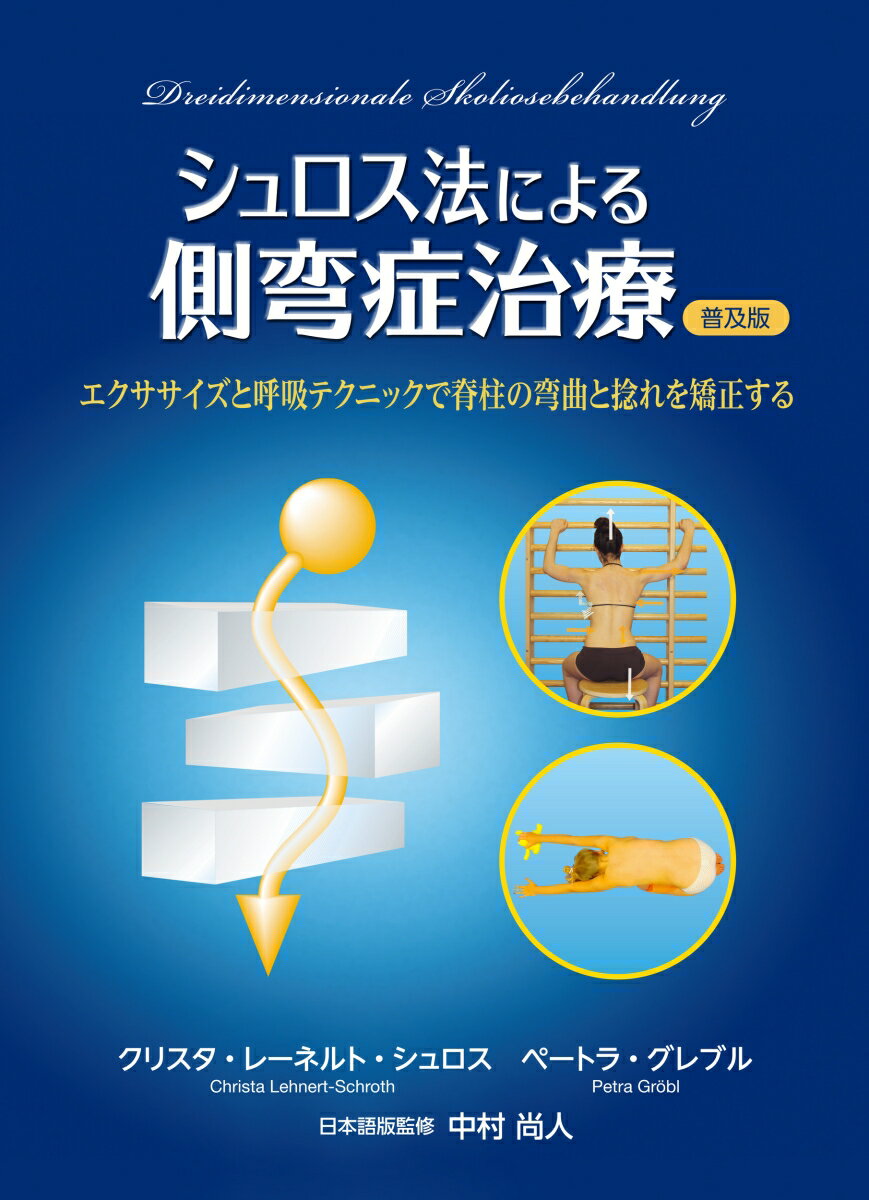 シュロス法による側弯症治療　普及版
