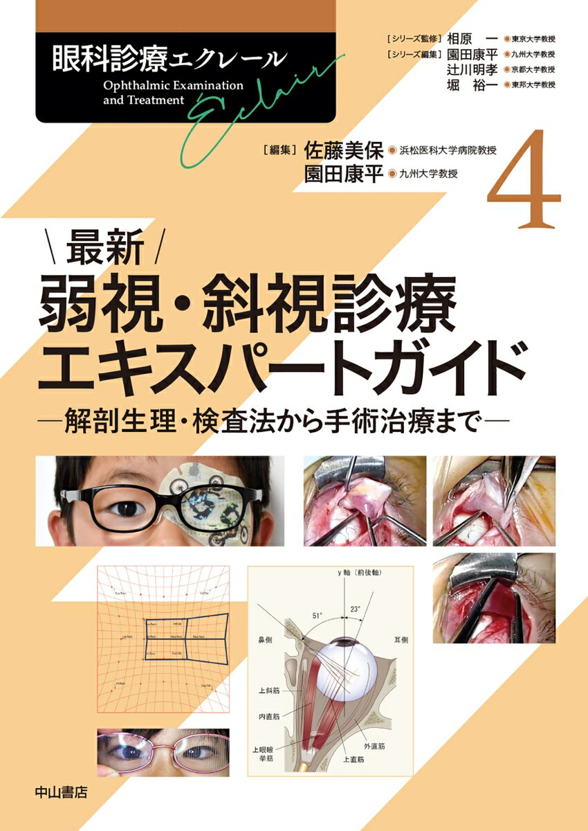 最新 弱視・斜視診療エキスパートガイドー解剖生理・検査法から手術治療まで（第4巻）