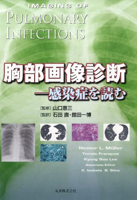 肺感染症は、罹患や死亡の主たる原因の１つである。ここ最近、様々な感染症の流行のみならず、新しい重大な病原体も認識されるようになってきている。本書は、肺感染症の鑑別診断を行うにあたっての胸部Ｘ線写真の価値と限界、ＣＴの適応、最適のＣＴ技法および造影剤の役割などを示している。豊富なＸ線写真とＣＴ画像、さらに実用的な表によって、簡潔で実践的なアプローチが得られ、肺感染症患者の評価における画像の価値と限界を知ることができる。放射線科医、呼吸器内科医はもちろん、呼吸器感染症の患者を診ている一般内科医や開業医にも有用な一冊。