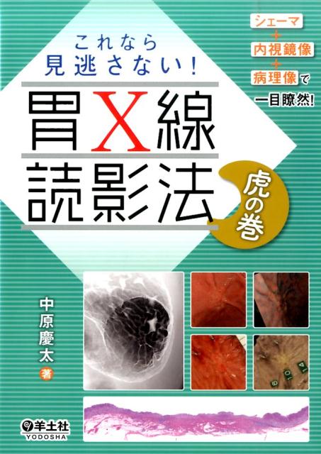 これなら見逃さない！胃X線読影法虎の巻 シェーマ＋内視鏡像＋病理像で一目瞭然！ 