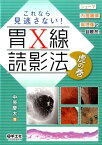 これなら見逃さない！胃X線読影法虎の巻 シェーマ＋内視鏡像＋病理像で一目瞭然！ [ 中原慶太 ]