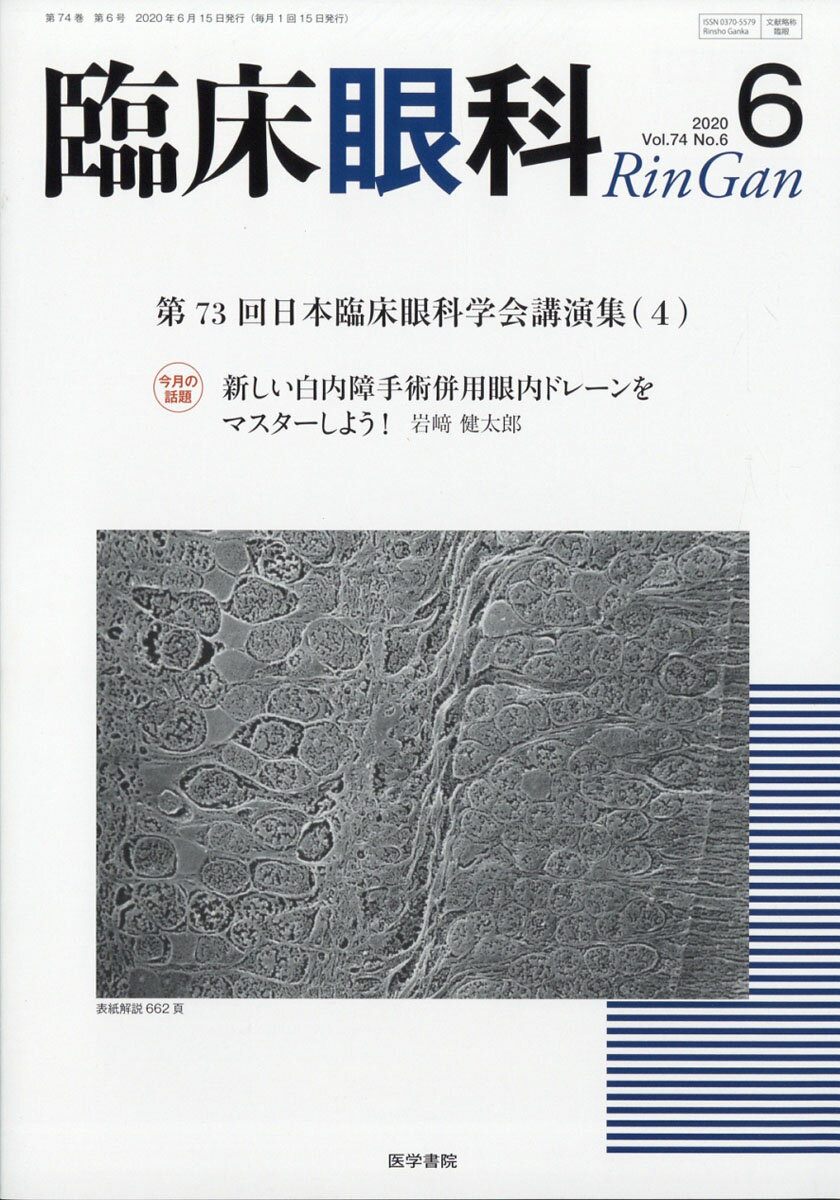 臨床眼科 2020年 06月号 [雑誌]