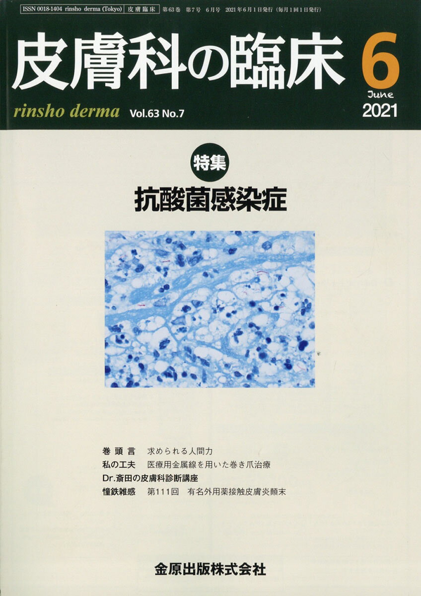 皮膚科の臨床 2021年 06月号 [雑誌]