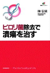 ピロリ菌除去で潰瘍を治す