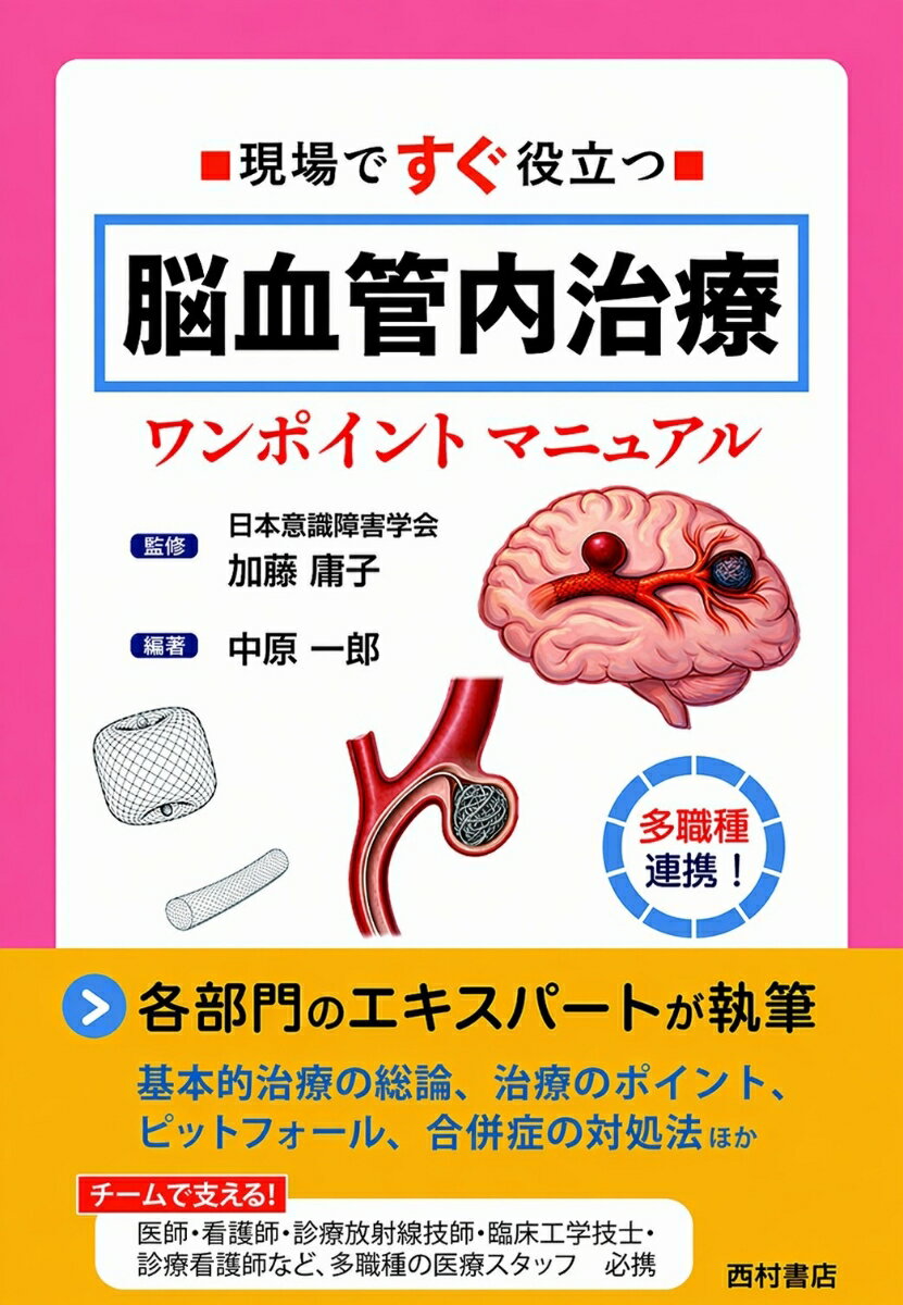 現場ですぐ役立つ 脳血管内治療ワンポイントマニュアル