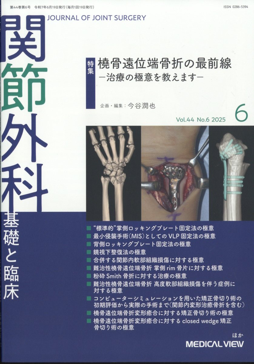 関節外科 基礎と臨床 2025年 6月号 [雑誌]