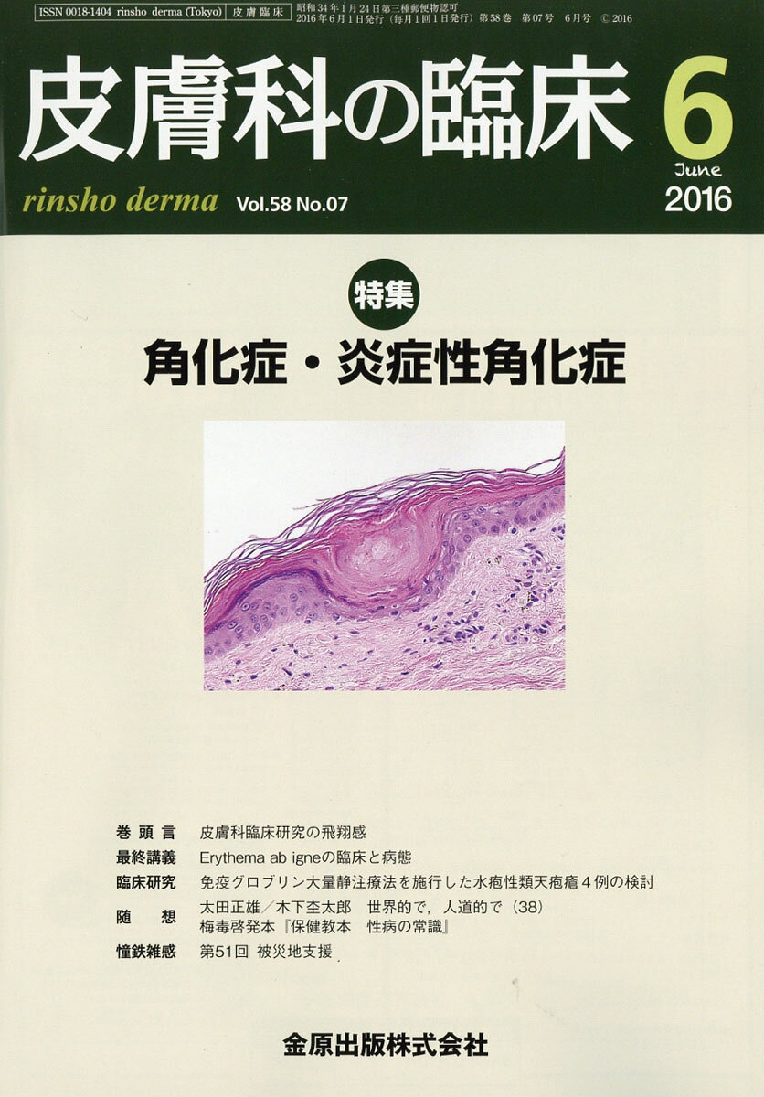 皮膚科の臨床 2016年 06月号 [雑誌]