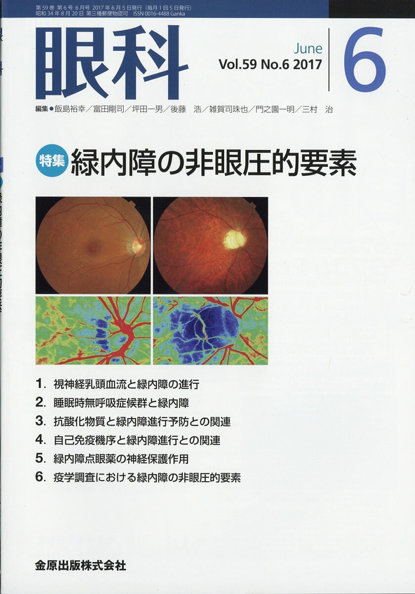 眼科 2017年 06月号 [雑誌]